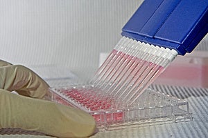 Scienziato che utilizza blu pipetta multicanale per il pipettaggio di una piastra da 96 pozzetti con rosa soluzione su bianco.