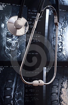Stetoskop opretý MRI bedrových disk všetky údaje sú anonymné.