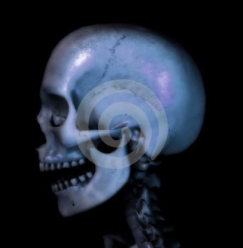 Éste es un computadora generado imagen de cráneo.